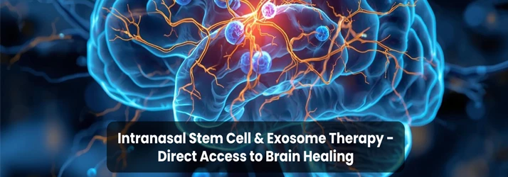 Intranasal Stem Cell & Exosome Therapy – Direct Access to Brain Healing In Sarasota FL