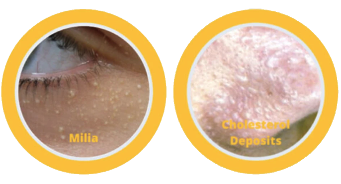 skin-conditions-treated-03