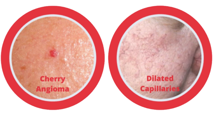 skin-conditions-treated